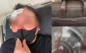 Dừng xe nghe điện thoại, người phụ nữ bị đánh giữa phố Hà Nội bằng gậy sắt: Nguyên nhân được tiết lộ