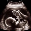 Nam diễn viên Việt và vợ Hoa khôi thông báo có con sau gần 2 năm kết hôn