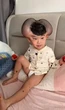 Nốt ruồi khổng lồ phủ kín hộp sọ khiến cậu bé có ngoại hình giống chuột Mickey