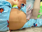 Bình Thuận: Cháu bé 3 tuổi nghi bị bạo hành tại điểm giữ trẻ tự phát