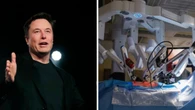 Tại sao Elon Musk dám khẳng định robot sẽ vượt mặt cả những bác sĩ phẫu thuật giỏi nhất thế giới trong 5 năm tới?