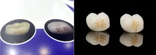 Độc lạ trào lưu xăm răng của giới trẻ Trung Quốc