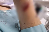 2 phụ nữ chém nhau bị thương nặng vì ghen tuông ở Thái Bình: Hé lộ tình trạng hôn nhân phức tạp