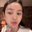 Chu Thanh Huyền lộ cằm bầm tím trên livestream, netizen tiếc thay nhan sắc thời chưa "dao kéo"