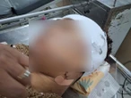 Nghi vấn nữ cán bộ xã ở Đồng Tháp rạch mặt người phụ nữ nhậu với chồng