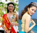 Hoa hậu Việt mắc bệnh lạ: Thường lên cơn co giật, bị bệnh viện trả về, 10 ngón tay đều có sẹo