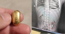 Con trai nuốt miếng vàng của mẹ vào bụng và cái kết