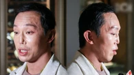 "Hoàng tử showbiz" bị vỡ nát gương mặt, phẫu thuật hơn 10 lần để sửa dung mạo méo mó biến dạng