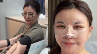 Diễn viên Vbiz "đập mặt xây lại" ở Hàn: Mặt băng bó chằng chịt, 2 đêm đầu khó chịu không thể thở