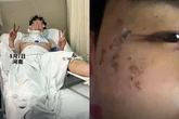 Nằm mơ mình bị rượt đuổi, thanh niên lao từ cửa sổ tầng 3 xuống đất mà không hề hay biết
