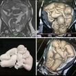 Ảnh siêu âm “chật kín” 4 em bé khiến hàng triệu người xem trầm trồ và cùng đặt 1 câu hỏi