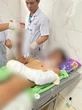 Bé trai 12 tuổi ở Đắk Lắk dập nát 2 bàn tay do pháo nổ