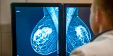 A co, jeśli rak piersi jest w twoich genach? Dyrektorka kliniki specjalistycznej odpowiada na palące kwestie