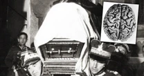 Ten organ Józef Piłsudski oddał nauce. Lekarz pokroił go na plasterki