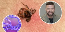 Justin Timberlake ma boreliozę. Te objawy wskazują na chorobę przenoszoną przez kleszcze. Uważaj na "rumień wędrujący"