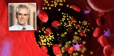 Miliony żyją z tym problemem i nawet o nim nie wiedzą. Kardiolog obala 8 groźnych mitów o cholesterolu