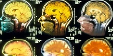 Siedzenie jako istotny czynnik ryzyka wystąpienia choroby Alzheimera. Nowe badanie