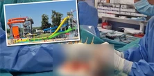 Wypadek na aquaparku w Raciborzu. 15-latek przeszedł ciężką operację
