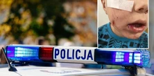 Zaatakował małego Frania. Dziecko cierpi, jego rodzice szukają właściciela bestii