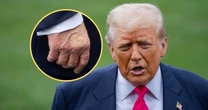 Zrobili zbliżenie na dłoń Donalda Trumpa. Niepokojące ślady pod lupą mediów