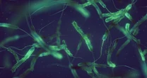 Cholera. Co ją wywołuje i czy jest możliwa epidemia?