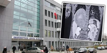 Myśleli, że to infekcja. Lekarze byli w szoku, gdy zobaczyli zdjęcie RTG: potężny guz u 4-latka