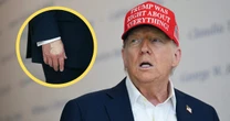 Dziwny wygląd dłoni Donalda Trumpa przykuł uwagę dziennikarzy. Biały Dom tłumaczy