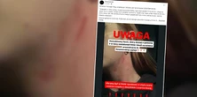 Wstrząsający atak na młodą kobietę. "Zaszedł mnie od tyłu, rzucił w krzaki i zaczął dusić"