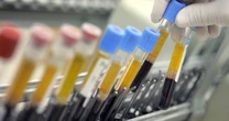 Niemal każdy Holender ma we krwi toksyczne chemikalia. Niepokojące wyniki badań