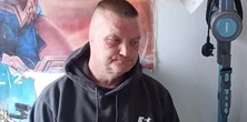 Smacznie spał na kanapie. Nagle podszedł do niego pies i odgryzł mu ucho