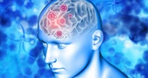 Meningite e encefalite: casos crescem no país; saiba como se proteger