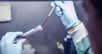 Parkinson: exame de sangue poderá diagnosticar a doença precocemente