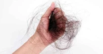 Por que estamos perdendo cabelo? Especialista explica possíveis causas
