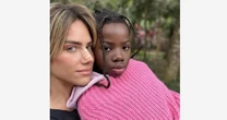 Giovanna Ewbank relata cirurgia no nariz por motivo de saúde e estética