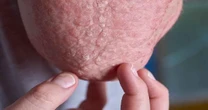 Dermatite: produto desenvolvido na UFJF ganha prêmio nacional