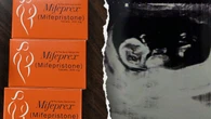Texas man sues California doctor in unprecedented abortion pill case over unborn child’s alleged ‘murder’