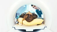 Never enter an MRI machine with any of these hazardous items, experts warn