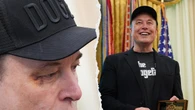 Elon Musk sports black eye at farewell presser in Oval Office: 'Horsing around with little X'