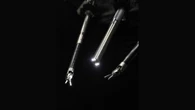AI robot performs gallbladder surgery autonomously