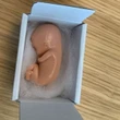 La denuncia dell’eurodeputata Pd Picierno: “Ho ricevuto feto di plastica da antiabortisti”