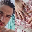 Tommaso Zorzi mostra la sua nuova manicure (che nasconde una dedica agli haters)