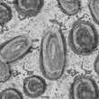 Come si è diffuso il vaiolo delle scimmie: primi studi suggeriscono la trasmissione sessuale