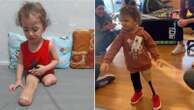 Gazan girl, 3, who lost both legs under Israeli bombardment walks again