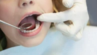 Bridgepoint close to filling portfolio with £750m dentistry group