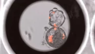 Human cells grown in monkey embryos triggers 'Pandora's box' ethical concerns