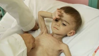 Crying babies dimmed by hunger fill this hospital - where parents fear each day might be the last