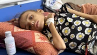 Every hospital in Gaza overwhelmed with malnutrition cases