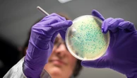 Salmonella cases reach highest levels in a decade