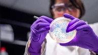 E.coli infections rise by 26% - as source of outbreaks and most vulnerable age groups revealed