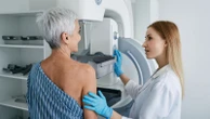 Cancer survival rates rise substantially but 'longer waits' hit progress, say researchers